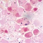 قيود على مزرعة سلمون في هيترا بعد تشخيص BKD